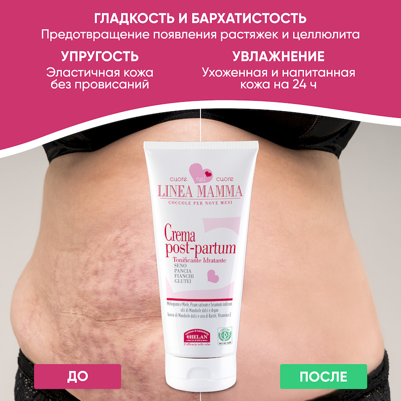 Крем для восстановл. фигуры после родов (Linea Mamma) - 150 мл. Фото №8 Крем для восстановл. фигуры после родов (Linea Mamma) - 150 мл. Фото №8